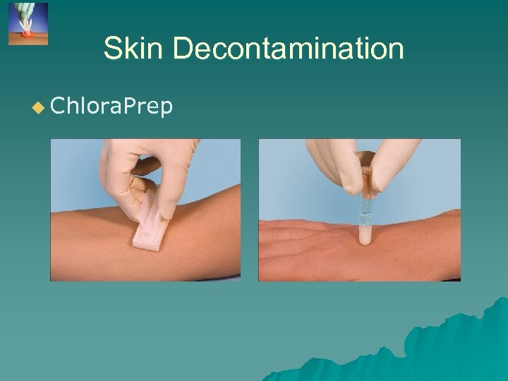 Skin Decontamination u Chlora. Prep 