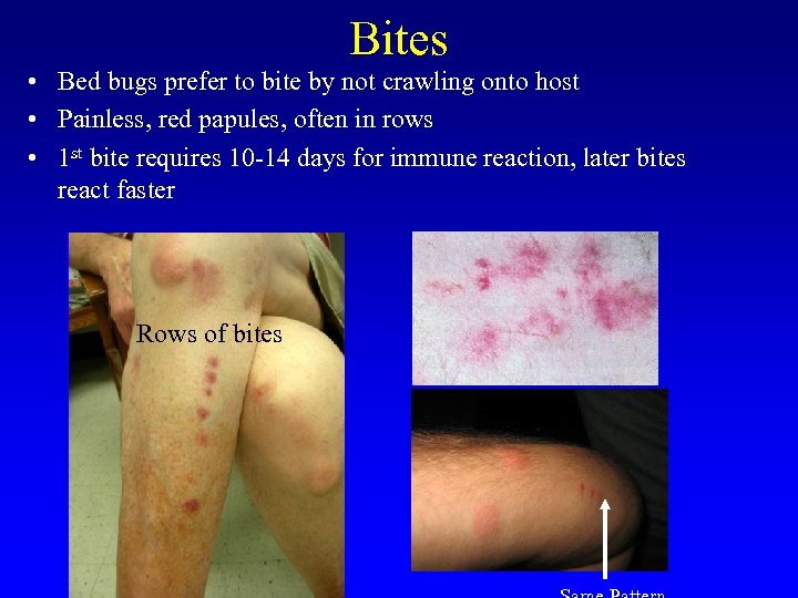 Bites • Bed bugs prefer to bite by not crawling onto host • Painless,