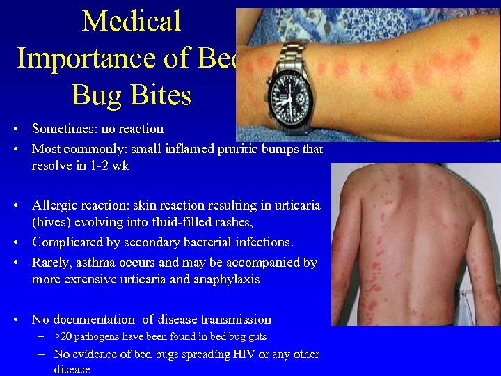 Medical Importance of Bed Bug Bites • Sometimes: no reaction • Most commonly: small