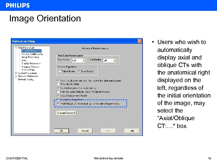Image Orientation • Users who wish to automatically display axial and oblique CTs with