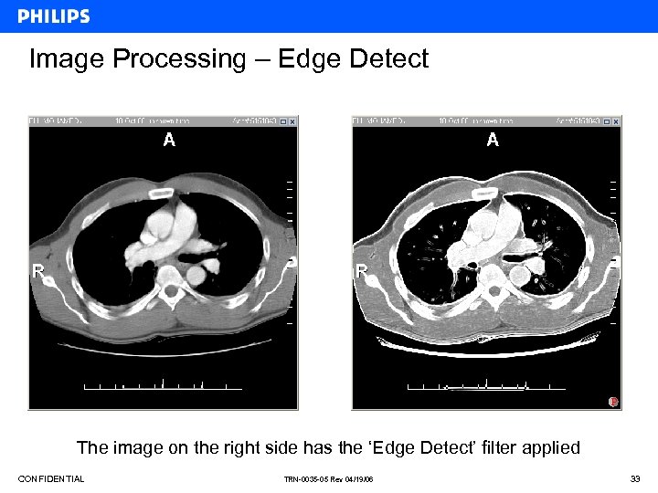 Image Processing – Edge Detect The image on the right side has the ‘Edge
