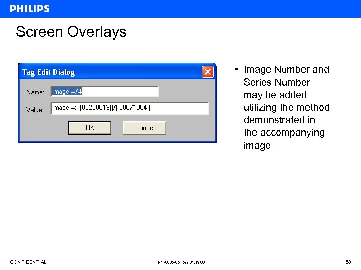 Screen Overlays • Image Number and Series Number may be added utilizing the method