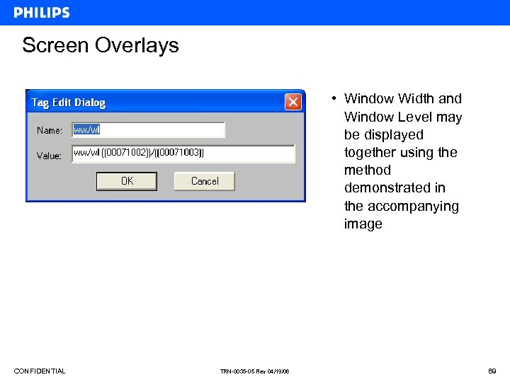 Screen Overlays • Window Width and Window Level may be displayed together using the