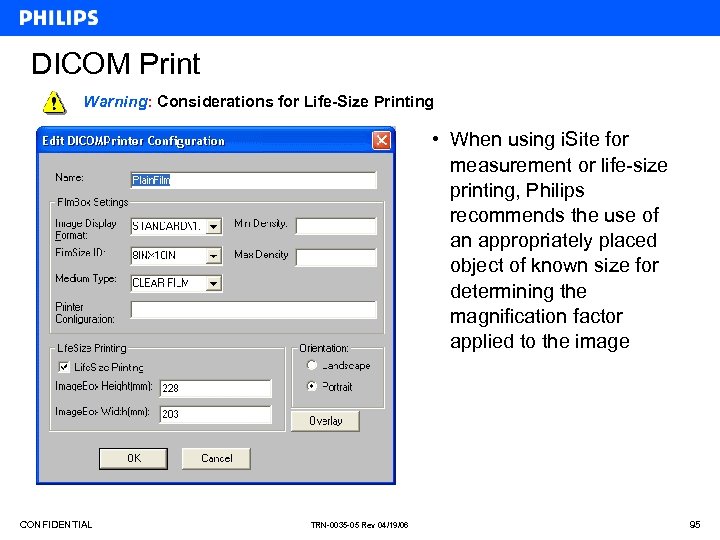 DICOM Print Warning: Considerations for Life-Size Printing • When using i. Site for measurement