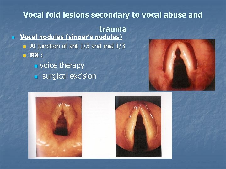 Vocal fold lesions secondary to vocal abuse and trauma n Vocal nodules (singer’s nodules)