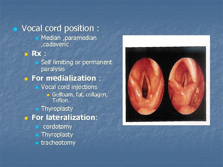 n Vocal cord position : n n Rx : n n Median , paramedian