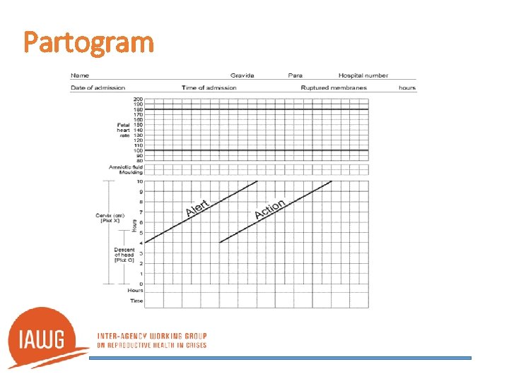 Partogram 