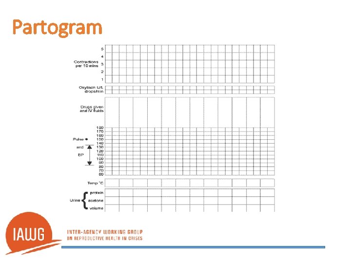 Partogram 