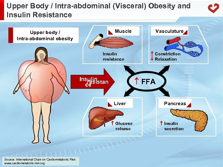 Upper Body / Intra-abdominal (Visceral) Obesity and Insulin Resistance Muscle Upper body / Intra-abdominal