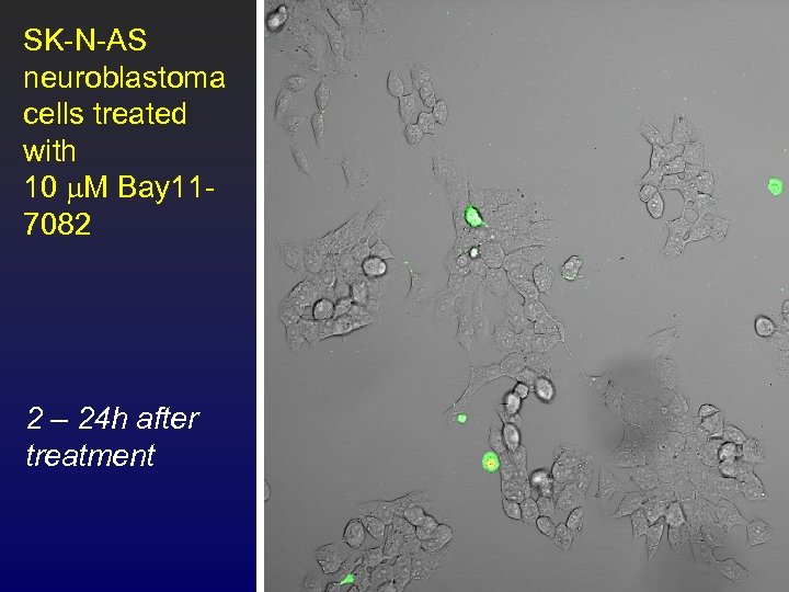 SK-N-AS neuroblastoma cells treated with 10 m. M Bay 117082 2 – 24 h