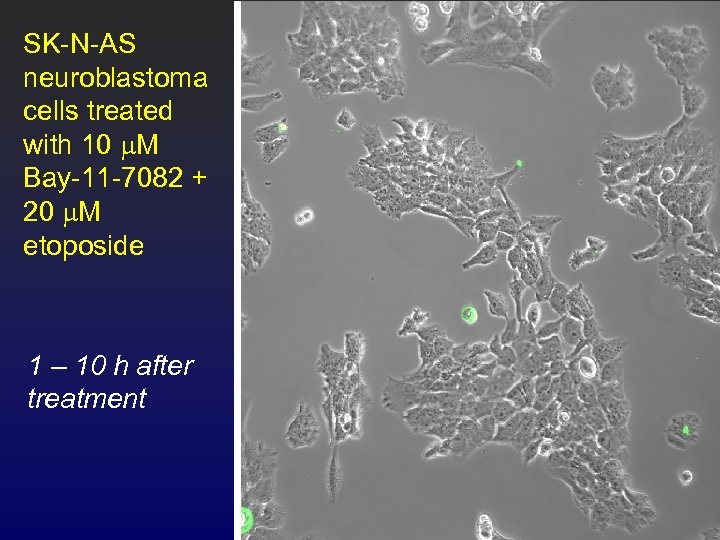 SK-N-AS neuroblastoma cells treated with 10 m. M Bay-11 -7082 + 20 m. M