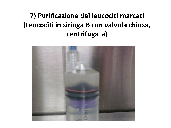 7) Purificazione dei leucociti marcati (Leucociti in siringa B con valvola chiusa, centrifugata) 