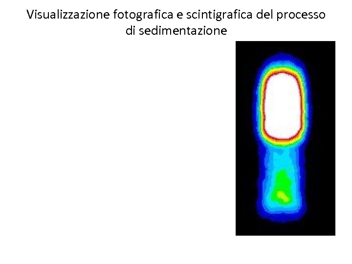 Visualizzazione fotografica e scintigrafica del processo di sedimentazione 