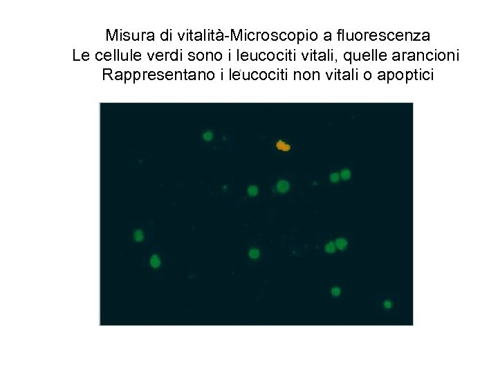 Misura di vitalità-Microscopio a fluorescenza Le cellule verdi sono i leucociti vitali, quelle arancioni