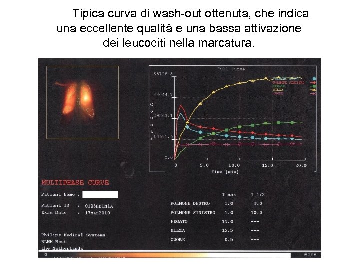 Tipica curva di wash-out ottenuta, che indica una eccellente qualità e una bassa attivazione