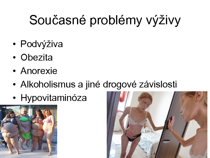 Současné problémy výživy • • • Podvýživa Obezita Anorexie Alkoholismus a jiné drogové závislosti