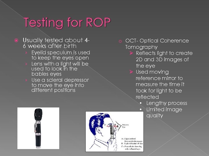 Testing for ROP Usually tested about 46 weeks after birth › Eyelid speculum is