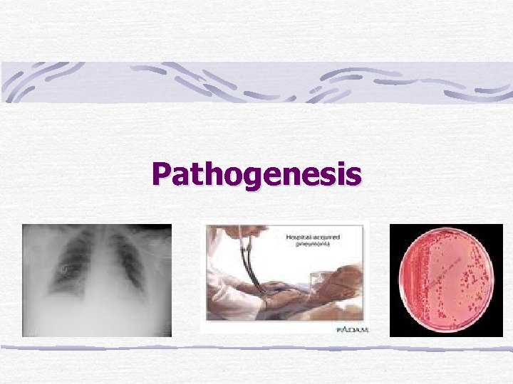 Pathogenesis 