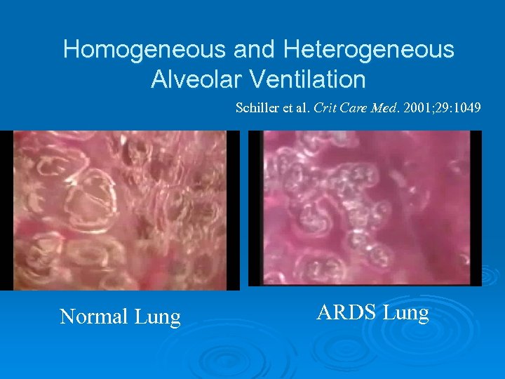 Homogeneous and Heterogeneous Alveolar Ventilation Schiller et al. Crit Care Med. 2001; 29: 1049