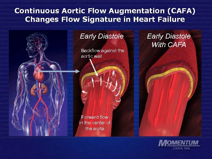 Continuous Aortic Flow Augmentation (CAFA) Changes Flow Signature in Heart Failure Early Diastole Backflow