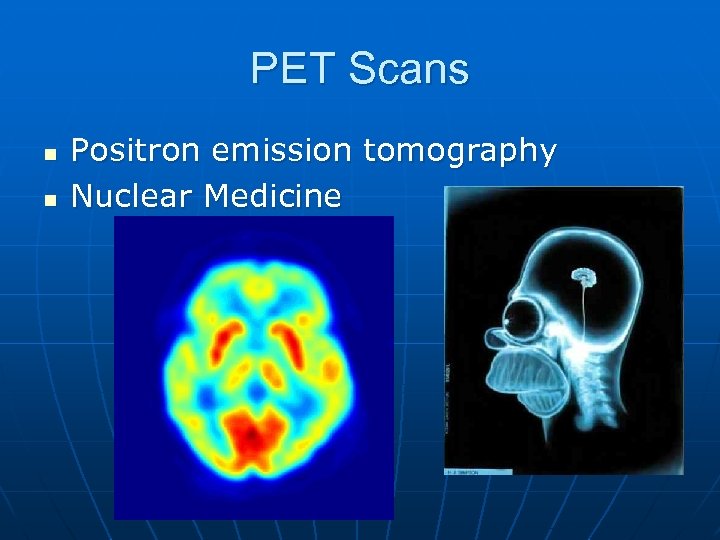 PET Scans n n Positron emission tomography Nuclear Medicine 