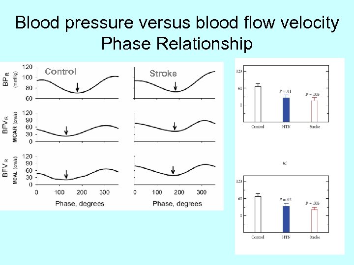 Blood pressure versus blood flow velocity Phase Relationship Control Stroke 