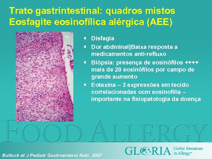 Trato gastrintestinal: quadros mistos Eosfagite eosinofílica alérgica (AEE) · Disfagia · Dor abdminal]Baixa resposta