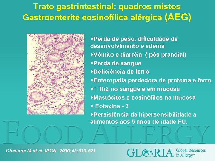 Trato gastrintestinal: quadros mistos Gastroenterite eosinofílica alérgica (AEG) ·Perda de peso, dificuldade de desenvolvimento