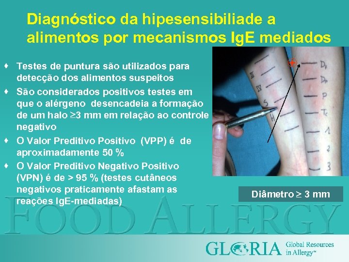 Diagnóstico da hipesensibiliade a alimentos por mecanismos Ig. E mediados · Testes de puntura