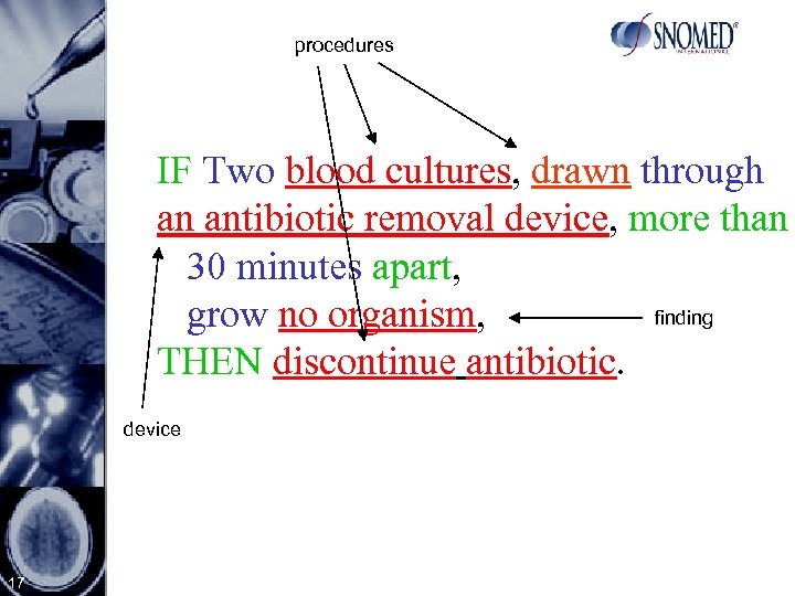 procedures IF Two blood cultures, drawn through an antibiotic removal device, more than 30