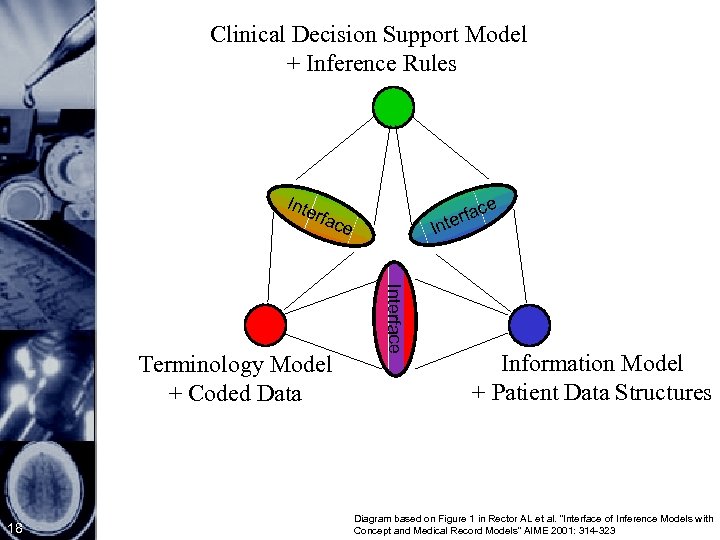 Clinical Decision Support Model + Inference Rules Inte e c erfa t rfac 18