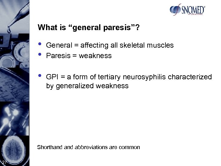 What is “general paresis”? • • General = affecting all skeletal muscles Paresis =