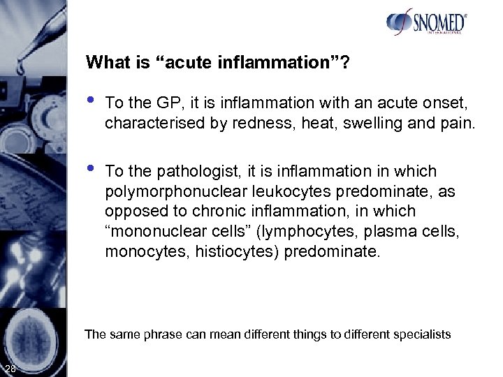 What is “acute inflammation”? • To the GP, it is inflammation with an acute