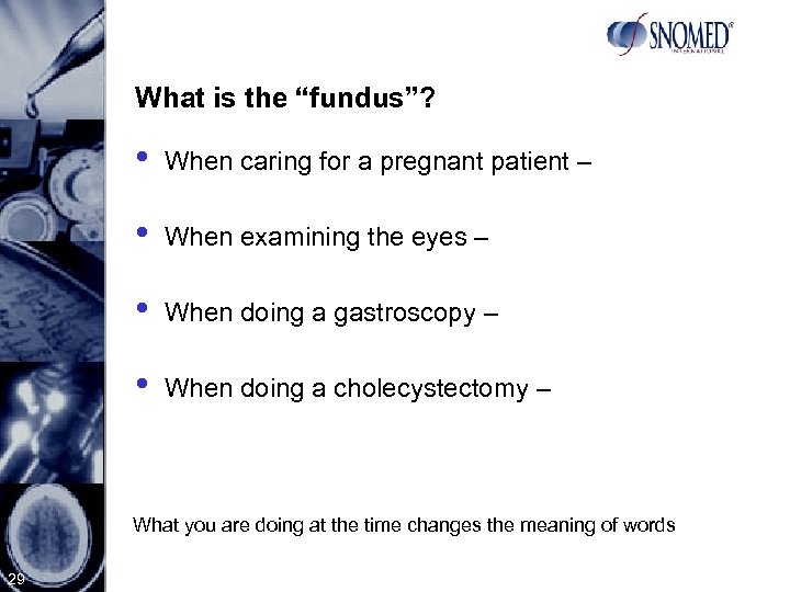 What is the “fundus”? • When caring for a pregnant patient – • When