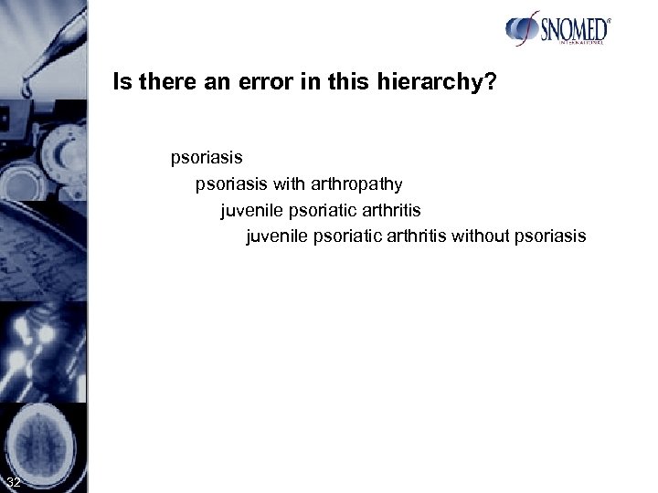 Is there an error in this hierarchy? psoriasis with arthropathy juvenile psoriatic arthritis without