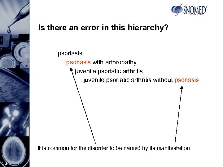 Is there an error in this hierarchy? psoriasis with arthropathy juvenile psoriatic arthritis without
