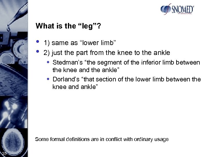 What is the “leg”? • • 1) same as “lower limb” 2) just the