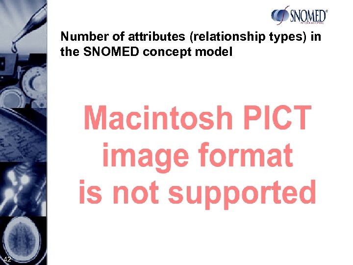 Number of attributes (relationship types) in the SNOMED concept model 42 