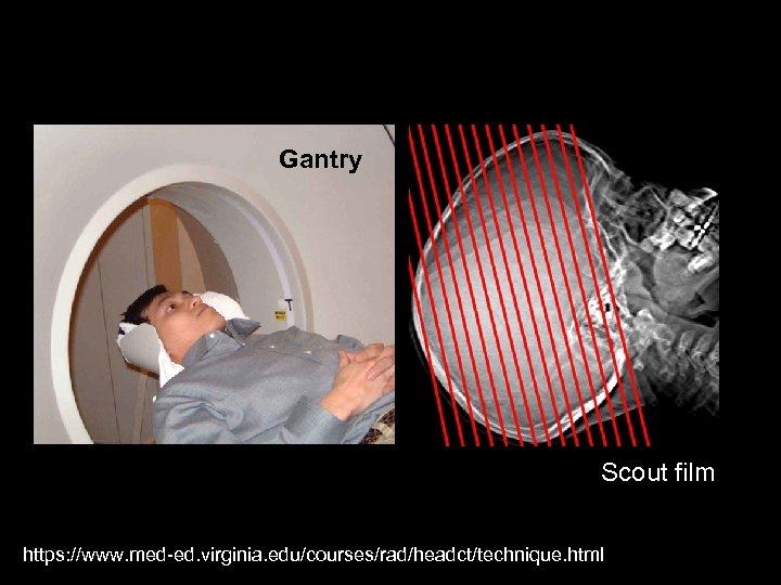 Gantry Scout film https: //www. med-ed. virginia. edu/courses/rad/headct/technique. html 