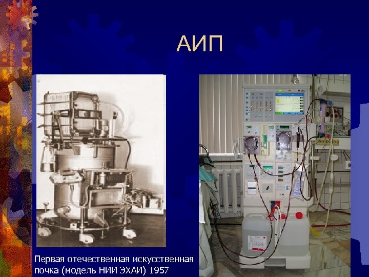 АИП Первая отечественная искусственная почка (модель НИИ ЭХАИ) 1957 