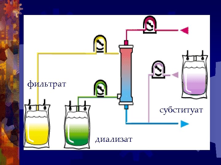 фильтрат субституат диализат 