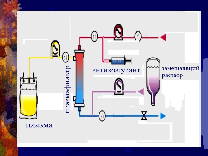 плазмафильтр плазма антикоагулянт замещающий раствор 