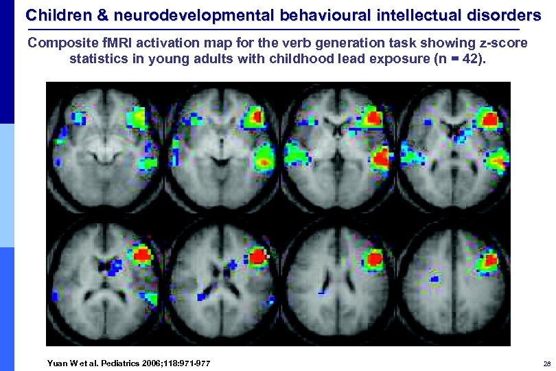 Children & neurodevelopmental behavioural intellectual disorders Composite f. MRI activation map for the verb