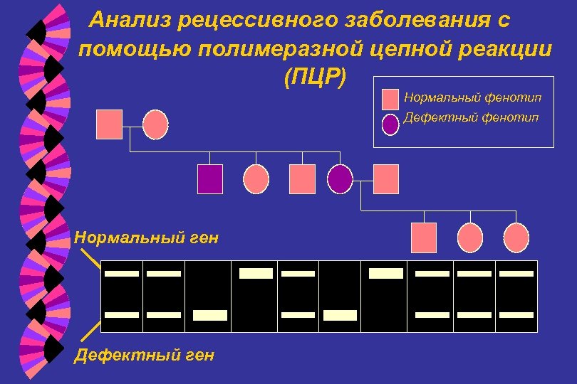 Анализ рецессивного заболевания с помощью полимеразной цепной реакции (ПЦР) Нормальный фенотип Дефектный фенотип Нормальный