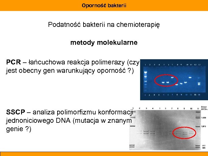 Oporność bakterii Podatność bakterii na chemioterapię metody molekularne PCR – łańcuchowa reakcja polimerazy (czy