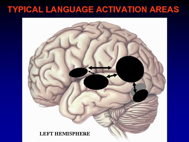 TYPICAL LANGUAGE ACTIVATION AREAS LEFT HEMISPHERE 