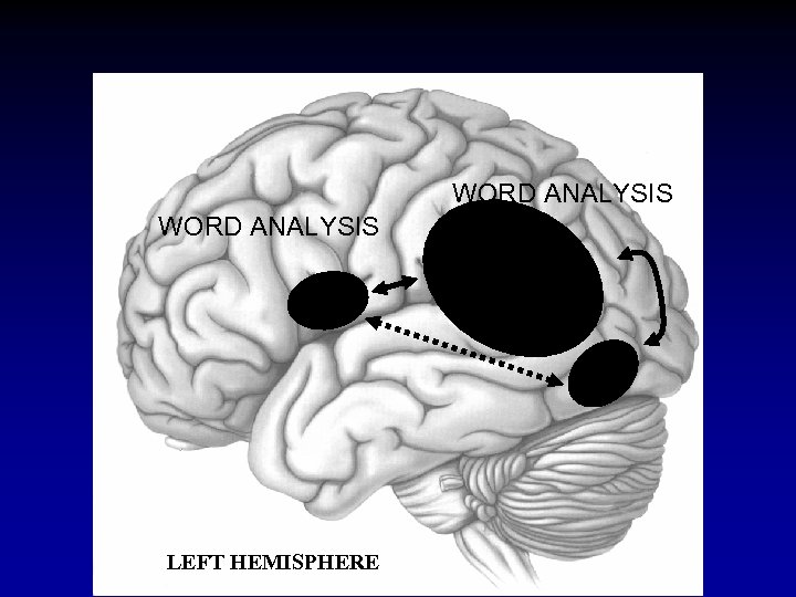 WORD ANALYSIS LEFT HEMISPHERE 