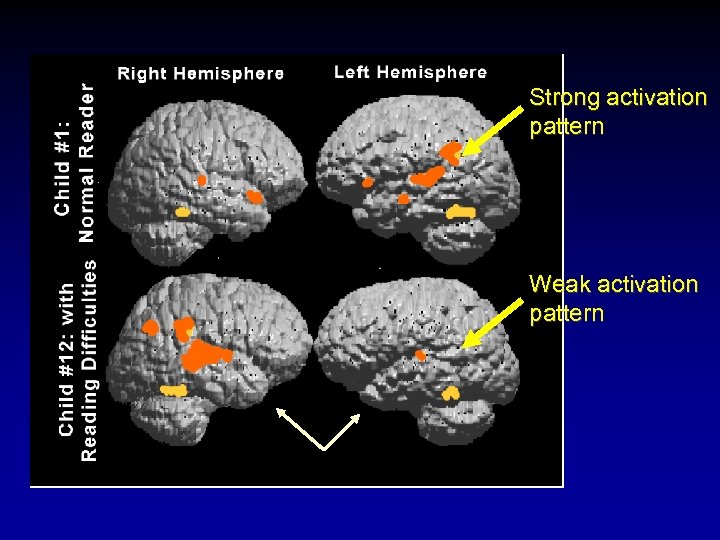 Strong activation pattern Weak activation pattern 