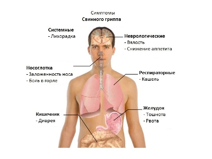 Симптомы гриппа тест. Симптомы гриппа. Клиническая картина гриппа. Симптомы заражения гриппом. Признаки гриппа.