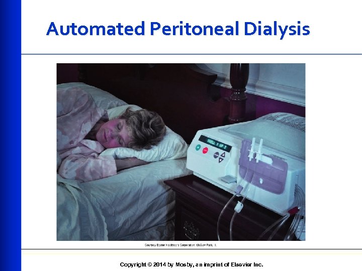 Automated Peritoneal Dialysis Copyright © 2014 by Mosby, an imprint of Elsevier Inc. 